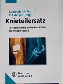 Cap 7.2: Bi-uni und bi-uni + femoro-patellarer Gelenkersatz