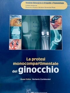 Cap 9: Protesi monocompartimentale computer-assistita